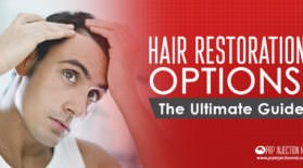 hair restoration options ultimate guide