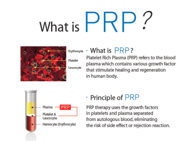 What is PRP