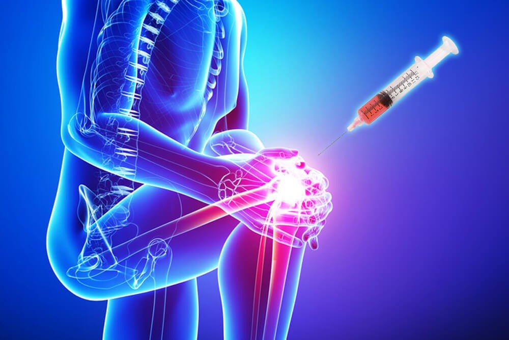 stem cell treatment for arthritis