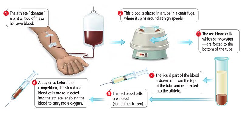 PRP Therapy for Sports Injuries