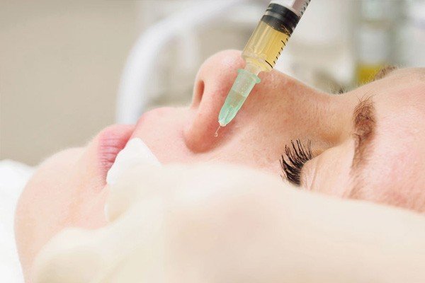 Getting PRP Scar Treatment is Quick and Simple Image - PRP