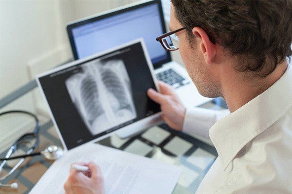 COPD Reverse Lung Damage Image - PRP