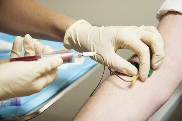 Cortisone Injections vs PRP Injection Elbow Treatments Image