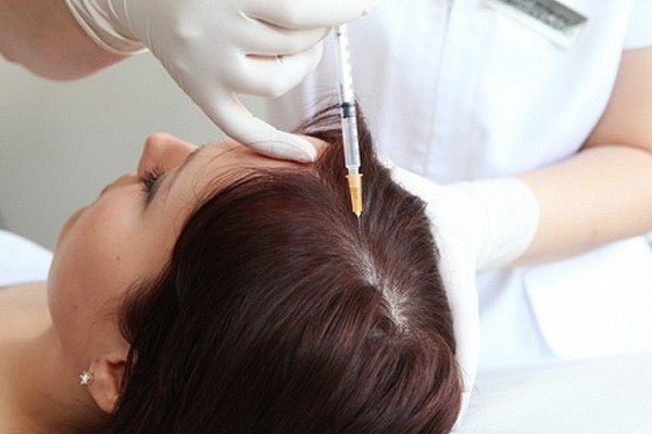 Injections for Hair Treatment Image - PRP