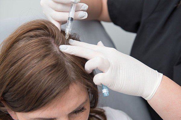 Hair Treatment Painful Image - PRP