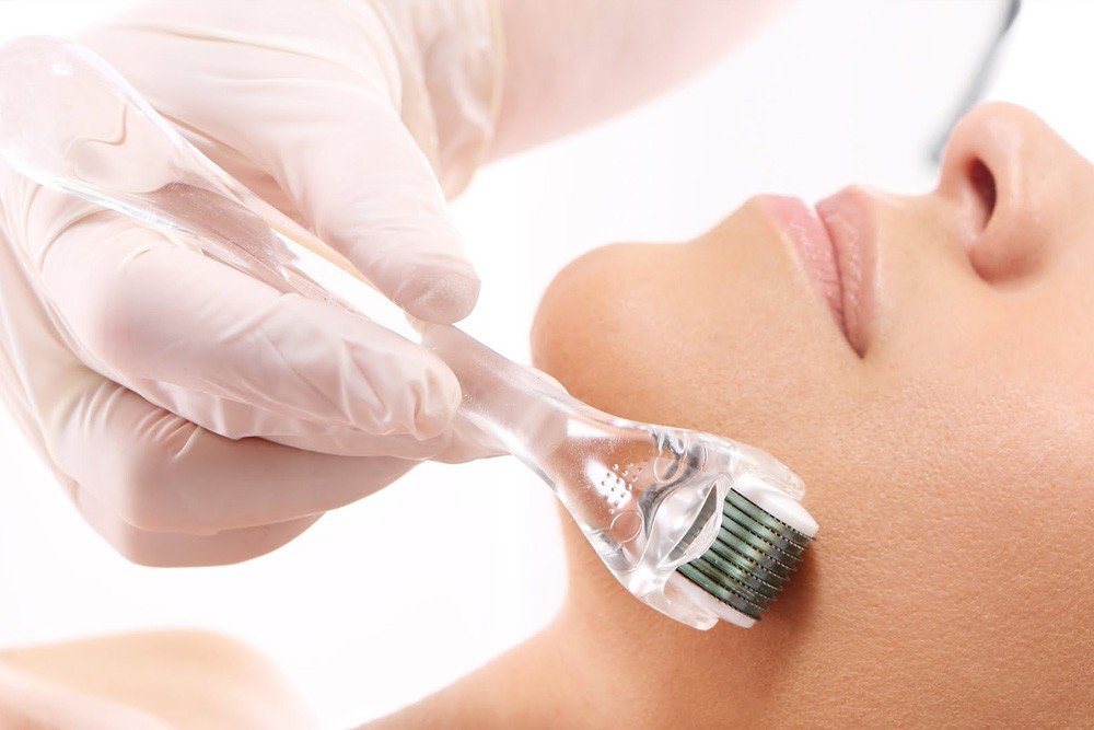 Benefits of Microneedling and PRP Therapy