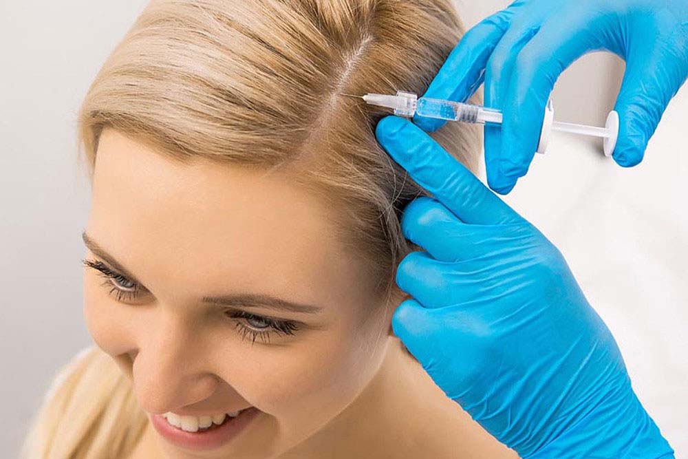 PRP Injection for Hair Loss Side Effects | PRP Injection MD