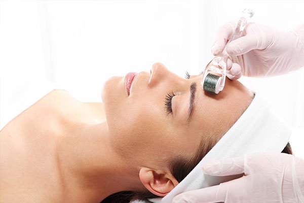 Microneedling-for-Ice-Pick-Scars