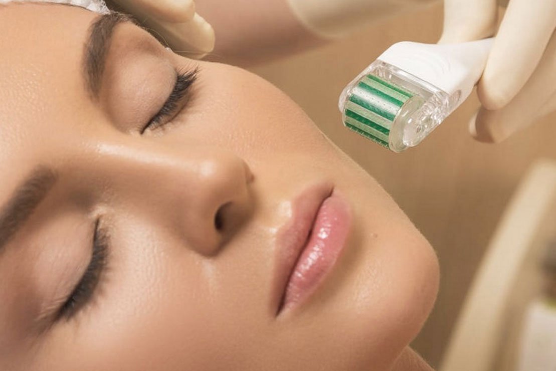 Microneedling for Acne Scars PRP Therapy with Microneedling