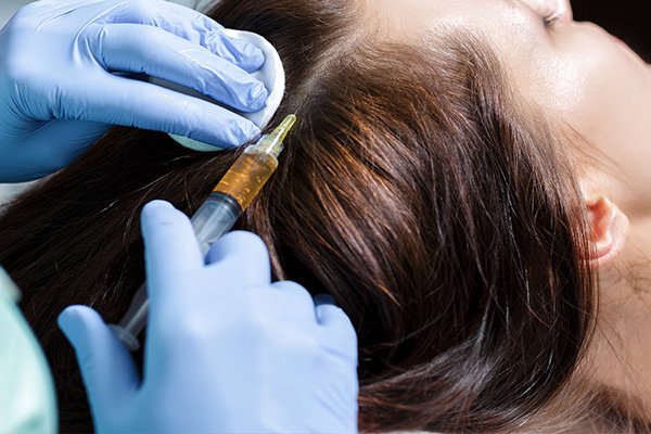 prp-treatments-needed-hair-growth